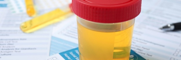 Urine Cup Drug Tests