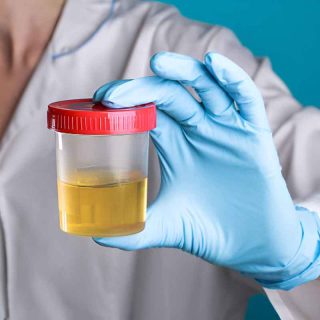 Urine Cup Drug Tests