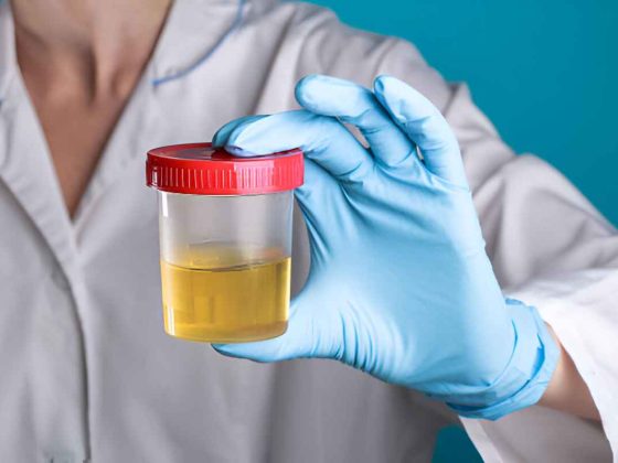 Urine Cup Drug Tests