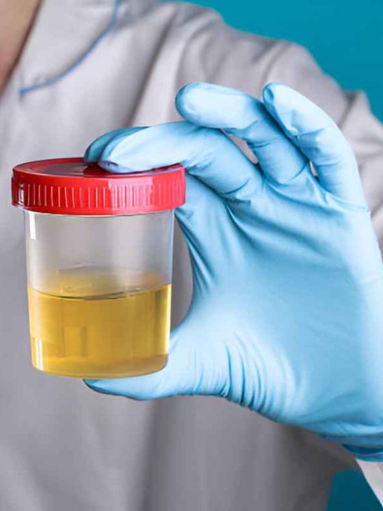 Urine Cup Drug Tests