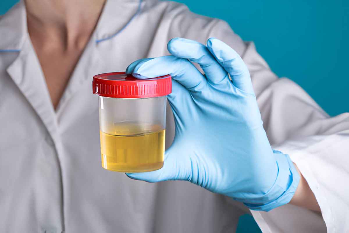 Urine Cup Drug Tests